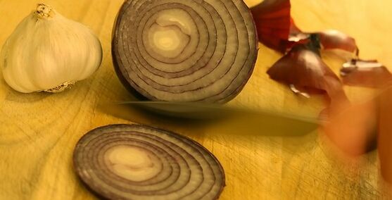 Knoblauch und Zwiebeln zur Behandlung von Nagelpilz